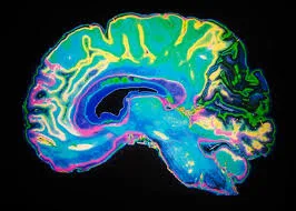 How Pornography Affects Your Brain [is porn good for you?]